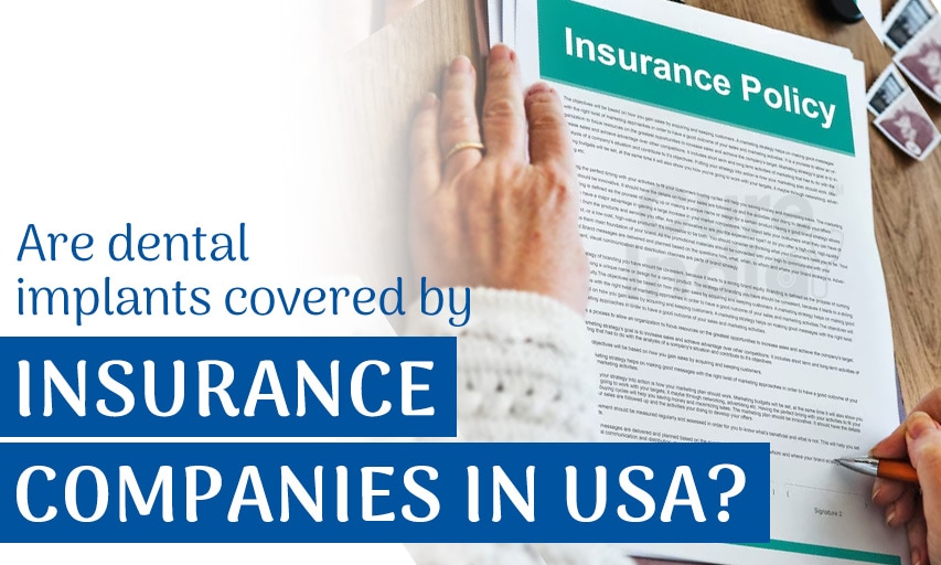 Are dental implants covered by insurance companies in USA?